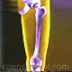 Femur Bone