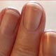Fingernails