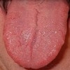 Tongue